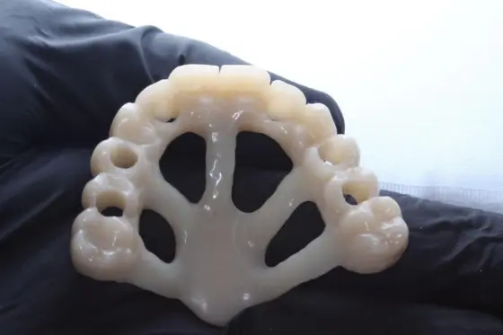 Base de resina de una prótesis removible en fase de laboratorio